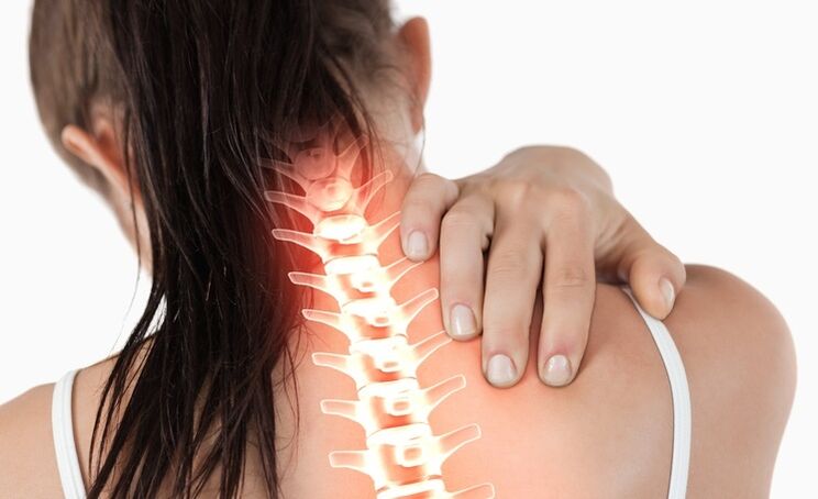 Die zervikale Osteochondrose ist durch Verspannungen und Schmerzen im Nacken gekennzeichnet. 